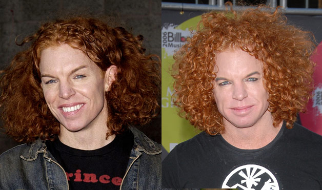 carrot top before and after. Carrot Top before and after